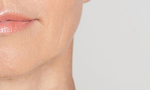 soins esthetiques clinique vena accueil mob